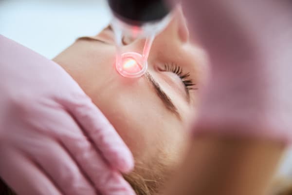 skin resurfacing