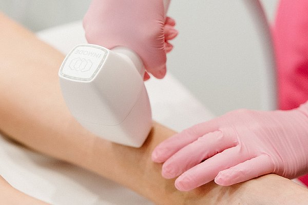 Laser Hair Removal